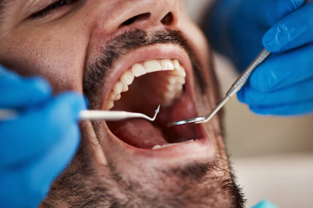 Best Emergency Treatment for Dental Infections or Abscesses in Lonoke, AR