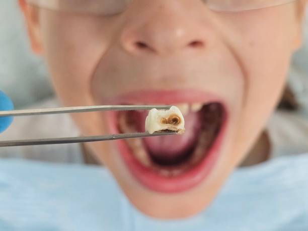Best Same-Day Emergency Dental Services in Lonoke, AR